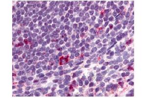 Immunohistochemical staining of spleen lymphocytes using antibody ABIN122022 (CCR2 Antikörper)