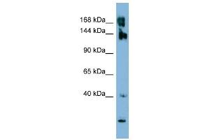 WNK3 antibody used at 1 ug/ml to detect target protein.