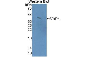 Western blot analysis of the recombinant protein. (PDE12 Antikörper  (AA 290-602))