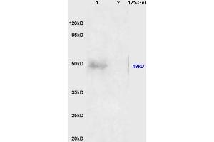 Lane 1: human colon carcinoma lysates Lane 2: mouse embryo lysates probed with Anti AVPR2 Polyclonal Antibody, Unconjugated (ABIN1386214) at 1:200 in 4 °C.