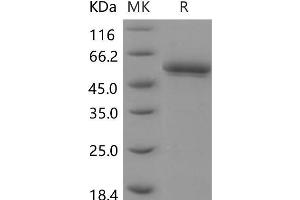 BACE2 Protein (His tag)