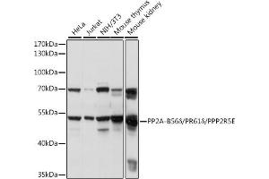 Western Blotting (WB) image for anti-Protein Phosphatase 2, Regulatory Subunit B', epsilon Isoform (PPP2R5E) (AA 398-467) antibody (ABIN7269691)