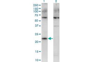 Western Blot analysis of CMTM4 expression in transfected 293T cell line by CMTM4 monoclonal antibody (M02), clone 1B9.