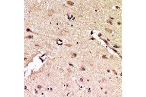 Immunohistochemical analysis of ALB staining in human brain formalin fixed paraffin embedded tissue section. (Albumin Antikörper  (C-Term))