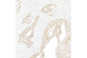 Immunohistochemistry (IHC) image for anti-Met Proto-Oncogene (MET) (C-Term) antibody (ABIN7795683) (Rekombinanter c-MET Antikörper  (C-Term))