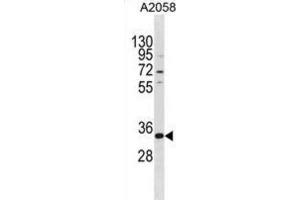 Western Blotting (WB) image for anti-TGFB-Induced Factor Homeobox 2-Like, X-Linked (TGIF2LX) antibody (ABIN3000268) (TGIF2LX Antikörper)