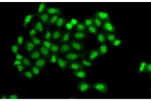 Immunofluorescence analysis of A549 cells using PHF11 Polyclonal Antibody (PHF11 Antikörper)