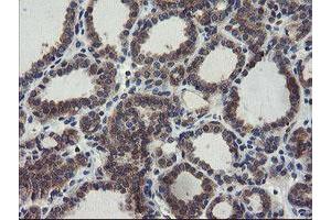 Image no. 3 for anti-Copper Metabolism (Murr1) Domain Containing 1 (COMMD1) antibody (ABIN1497563)