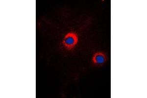 Immunofluorescent analysis of GRP94 staining in NIH3T3 cells.