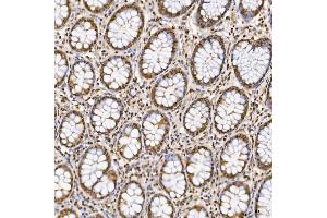 IHC analysis of SNRNP27 using anti-SNRNP27 antibody (ABIN7599614). (SNRNP27 Antikörper  (AA 100-155))