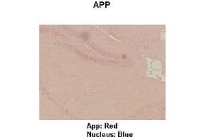 Sample Type : Mouse hippo campus  Primary Antibody Dilution :  1:100  Secondary Antibody: Anti-rabbit-HRP  Secondary Antibody Dilution:  1:300  Color/Signal Descriptions: App: Red Nucleus: Blue  Gene Name: APP  Submitted by: Teresa Gunn