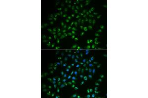 Immunofluorescence analysis of  cells using H antibody (ABIN6128002, ABIN6141597, ABIN6141598 and ABIN6222828). (HAND2 Antikörper  (AA 1-217))