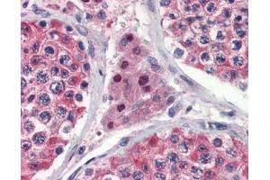 IDH1 antibody was used for immunohistochemistry at a concentration of 4-8 ug/ml. (IDH1 Antikörper)