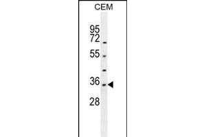 LDHAL6A Antibody (Center) (ABIN654842 and ABIN2844509) western blot analysis in CEM cell line lysates (35 μg/lane). (LDHAL6A Antikörper  (AA 154-183))