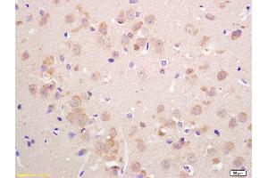 Immunohistochemistry (Paraffin-embedded Sections) (IHC (p)) image for anti-Solute Carrier Family 17 (Vesicular Glutamate Transporter), Member 6 (SLC17A6) (AA 1-50) antibody (ABIN1386150)