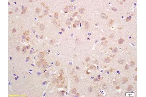 Formalin-fixed and paraffin embedded rat brain labeled with Anti-VGLUT2 Polyclonal Antibody, Unconjugated  at 1:200 followed by conjugation to the secondary antibody and DAB staining. (Solute Carrier Family 17 (Vesicular Glutamate Transporter), Member 6 (SLC17A6) (AA 1-50) Antikörper)