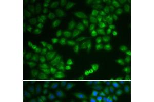 Immunofluorescence analysis of MCF-7 cells using RPL5 Polyclonal Antibody (RPL5 Antikörper)