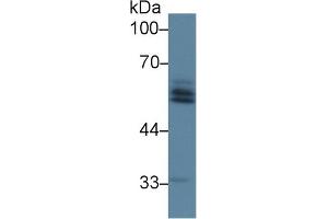 Detection of AGT in Rat Liver lysate using Polyclonal Antibody to Angiotensinogen (AGT) (AGT Antikörper  (AA 25-477))