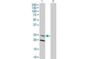Western Blot analysis of IL6 expression in transfected 293T cell line by IL6 monoclonal antibody (M09), clone 3F12. (IL-6 Antikörper  (AA 29-212))