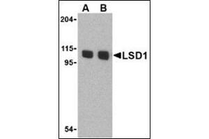 Western blot analysis of LSD1 in P815 cell lysate with this product at (A) 1 and (B) 2 μg/ml. (LSD1 Antikörper  (N-Term))