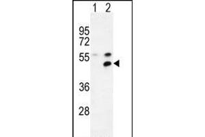 Western blot analysis of P1 (arrow) using rabbit polyclonal P1 Antibody (Center) (ABIN654665 and ABIN2844361). (MPP1 Antikörper  (AA 301-327))