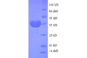SDS-PAGE (SDS) image for Mitochondrially Encoded Cytochrome B (MT-CYB) (AA 1-98), (full length) protein (GST tag) (ABIN5712043)