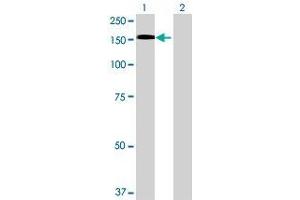 Lane 1: PLK4 transfected lysate ( 106.