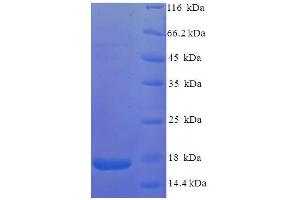 SDS-PAGE (SDS) image for Vpx Protein (VPX) (AA 1-113), (full length) protein (His tag) (ABIN5710828)