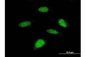 Immunofluorescence (IF) image for anti-Ribosomal Protein S6 Kinase, 70kDa, Polypeptide 2 (RPS6KB2) (AA 1-100) antibody (ABIN519898)