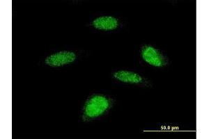 Immunofluorescence of monoclonal antibody to RPS6KB2 on HeLa cell.