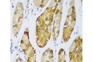 Immunohistochemistry of paraffin-embedded Human stomach using ERLIN1 Polyclonal Antibody at dilution of 1:100 (40x lens). (ERLIN1 Antikörper)