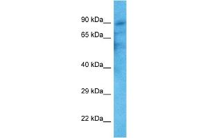 WB Suggested Anti-TRPV2 antibody Titration: 1 ug/mL Sample Type: Human HT1080 Whole Cell (TRPV2 Antikörper  (C-Term))