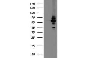 HEK293T cells were transfected with the pCMV6-ENTRY control (Left lane) or pCMV6-ENTRY DPH2 (Right lane) cDNA for 48 hrs and lysed. (DPH2 Antikörper)