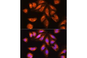Immunofluorescence analysis of U2OS cells using EXOSC2 Rabbit pAb (ABIN6127886, ABIN6140374, ABIN6140375 and ABIN6214708) at dilution of 1:100. (EXOSC2 Antikörper  (AA 1-293))