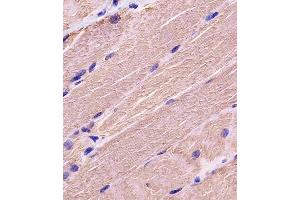 A staining MYBPC3 in human skeletal muscle tissue sections by Immunohistochemistry (IHC-P - paraformaldehyde-fixed, paraffin-embedded sections).