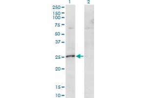 Western Blot analysis of MIS12 expression in transfected 293T cell line by MIS12 monoclonal antibody (M01), clone 1G3. (MIS12 Antikörper  (AA 1-205))