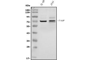 Western blot analysis of IL-18R Beta/IL-18RAP using anti-IL-18R Beta/IL-18RAP antibody (ABIN7602806).