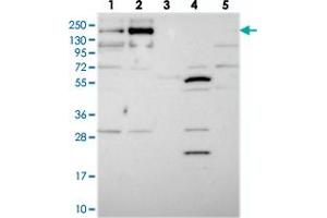 Western blot analysis of Lane 1: RT-4, Lane 2: U-251 MG, Lane 3: Human Plasma, Lane 4: Liver, Lane 5: Tonsil with TMEM2 polyclonal antibody  at 1:250-1:500 dilution.