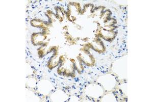 Immunohistochemistry of paraffin-embedded rat lung using S100A7 antibody (ABIN5974971) at dilution of 1/100 (40x lens). (S100A7 Antikörper)