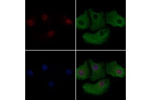 ABIN6266130 and ABIN6278773 staining Hela cells by IF/ICC.