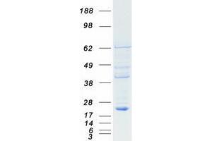 Validation with Western Blot (RBBP9 Protein (Myc-DYKDDDDK Tag))