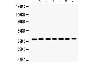 Western Blotting (WB) image for anti-Histone Deacetylase 11 (HDAC11) (AA 47-81), (N-Term) antibody (ABIN3043840)