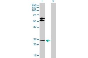 Western Blot analysis of TGIF2 expression in transfected 293T cell line by TGIF2 MaxPab polyclonal antibody. (TGIF2 Antikörper  (AA 1-237))