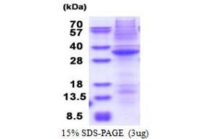 SDS-PAGE (SDS) image for serine/threonine Kinase 17a (STK17A) (AA 64-321) protein (His tag) (ABIN5853608) (STK17A Protein (AA 64-321) (His tag))