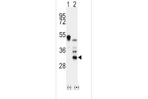 Western blot analysis of OD (arrow) using rabbit polyclonal OD Antibody (N-term) 7423a 293 cell lysates (2 μg/lane) either nontransfected (Lane 1) or transiently transfected with the OD gene (Lane 2).