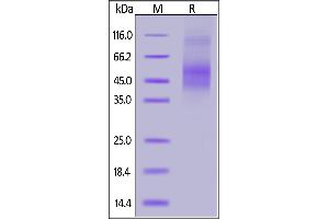 SDS-PAGE (SDS) image for AXL Receptor tyrosine Kinase (AXL) (AA 27-293) protein (His tag) (ABIN7013379)