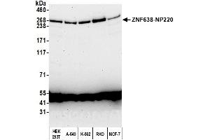Western Blotting (WB) image for anti-Zinc Finger Protein 638 (ZNF638) (AA 1928-1978) antibody (ABIN7450948) (ZNF638 Antikörper  (AA 1928-1978))