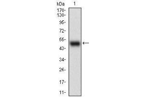 Western blot analysis using APBB1IP mAb against human APBB1IP (AA: 1-151) recombinant protein. (Amyloid beta (A4) Precursor Protein-Binding, Family B, Member 1 Interacting Protein (APBB1IP) (AA 1-151) Antikörper)