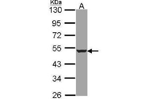 WB Image Sample (30 ug of whole cell lysate) A: A431 , 10% SDS PAGE HADHB antibody antibody diluted at 1:1000 (HADHB Antikörper  (N-Term))