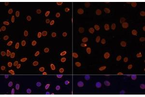 Immunofluorescence (IF) image for anti-Histone H2A (acLys5) antibody (ABIN7258522)